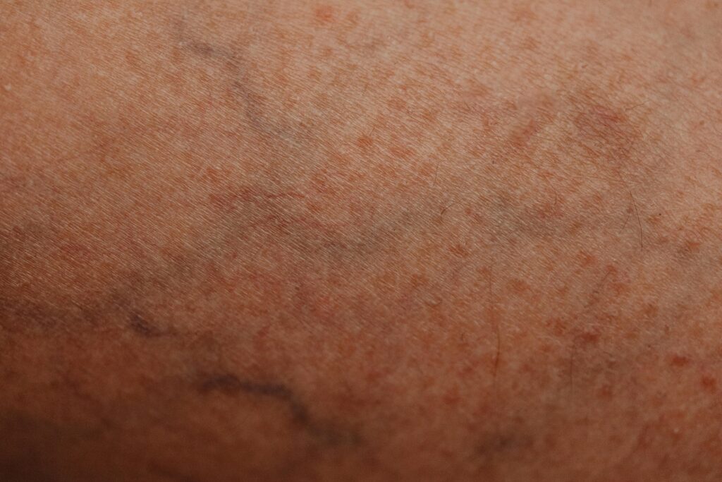 pexels photo 6643070 6643070 Detailed close-up of human skin with visible texture and veins, showcasing natural patterns.